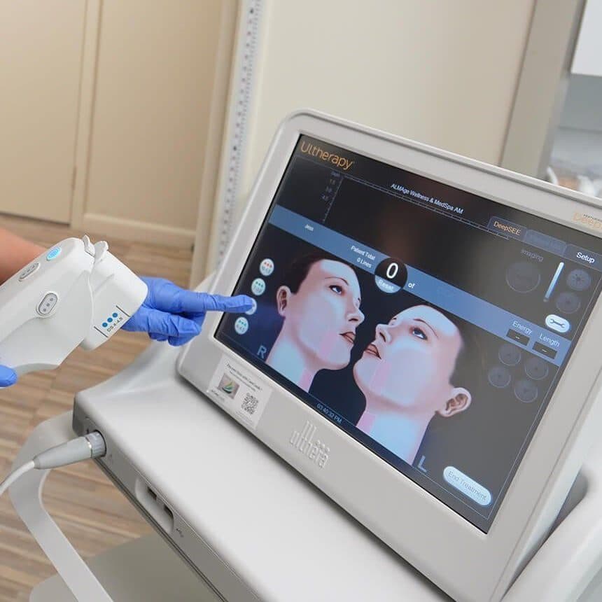 Ultherapy Full Face